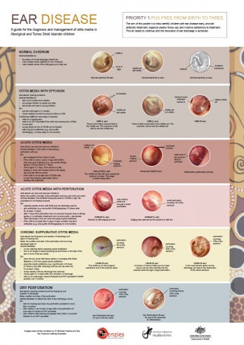 The Ear Disease Poster