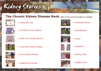 Kidney stories