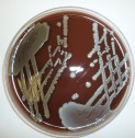 Researchers discover a new silver species of Staphylococcus
