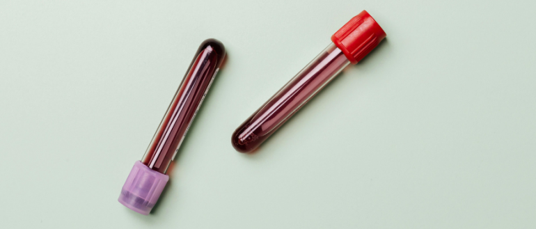 IMPACT study: The impact of symptomatic P. vivax infection on G6PD activity