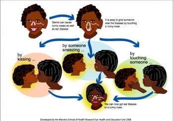 Transmission of otitis media