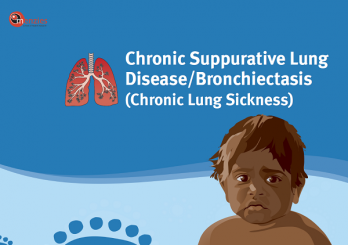 Chronic suppurative lung disease/bronchiectasis (chronic lung sickness)