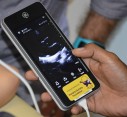 Cardiologists identify alarming levels of rheumatic heart disease in Timor-Leste