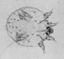 Trial results hold hope for scabies prevention