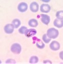 Platelets the first line of defence in malaria patients