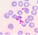 Platelets the first line of defence in malaria patients