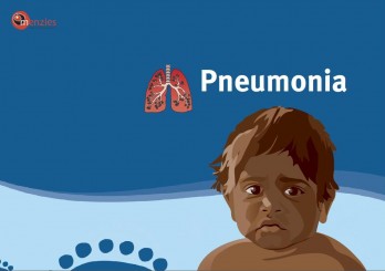 Pneumonia - paediatric