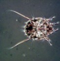 New test to diagnose scabies